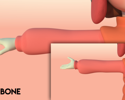 TwistBone